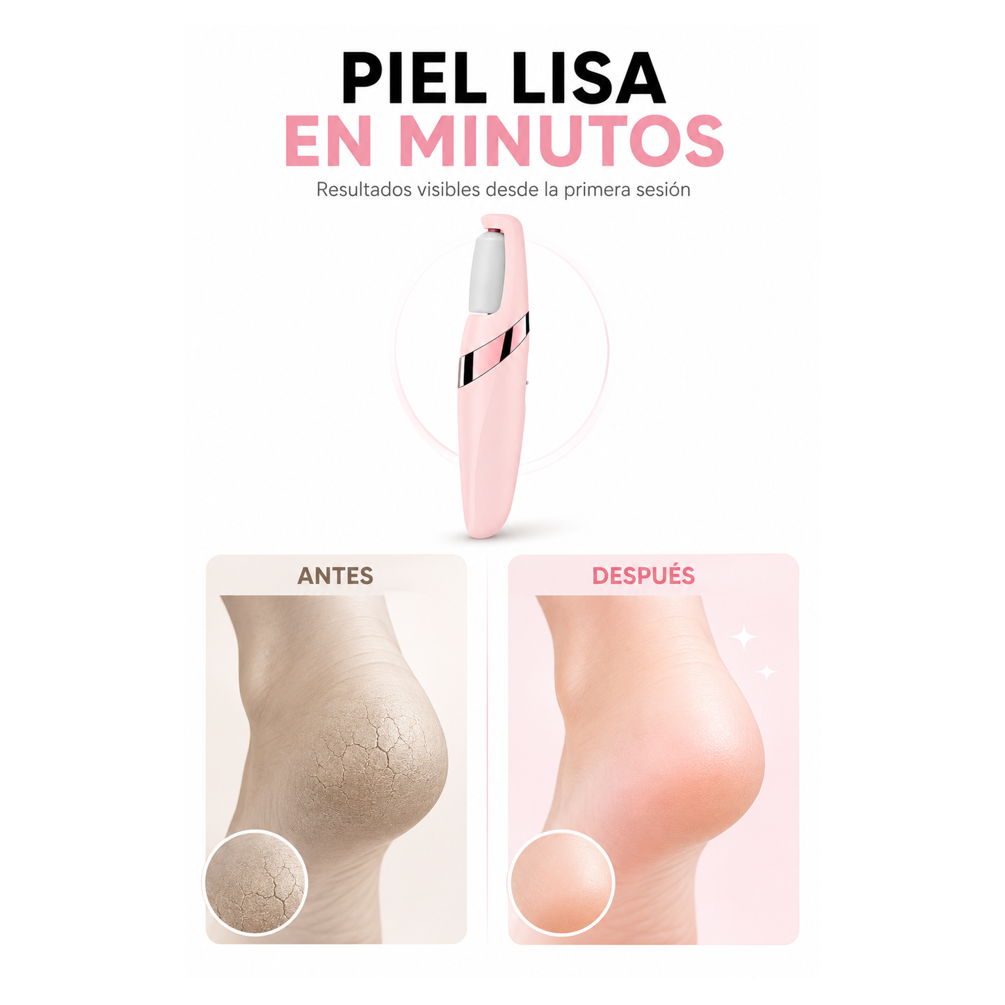 Removedor de Callos Eléctrico
